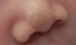 怀孕初期吃小白瓜,营养美味，助力宝宝健康成长